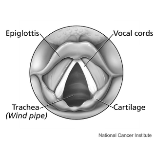 Illustration for article titled When you can't talk, but you can sing